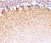 IHC testing of FFPE human cerebellum with Neurofilament antibody (clone MSI27-1). Staining of formalin-fixed tissues requires boiling tissue sections in pH 9 10mM Tris with 1mM EDTA for 10-20 min followed by cooling at RT for 20 min.