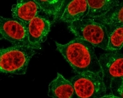 Immunofluorescent staining of human HeLa cells with B2M antibody (green, clone MGBP2-1) and Reddot nuclear stain (red).