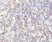 IHC testing of FFPE human spleen with TRAcP antibody (clone HACP5-1). FFPE testing requires sections to be boiled in pH6 10mM citrate buffer for 10-20 minutes, followed by cooling at RT for 20 minutes, prior to staining.