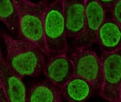 Immunofluorescent staining of permeabilized human HeLa cells with Histone H1 antibody (green, clone OSHT-2) and Phalloidin.