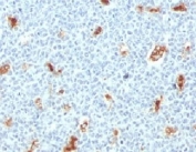 IHC testing of FFPE human tonsil with S100A9 antibody (clone PS1A9-1). Staining of formalin-fixed tissues requires boiling tissue sections in pH 9 10mM Tris with 1mM EDTA for 10-20 min followed by cooling at RT for 20 min.