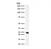 Western blot testing of human MCF7 cell lysate with Bcl2 antibody (clone ARBC2-1). Routinely observed at 18-22 kDa.