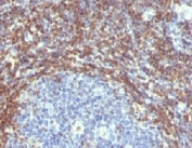 IHC testing of FFPE human tonsil with Bcl2 antibody (clone ARBC2-1). HIER: boil tissue sections in 10mM Tris with 1mM EDTA, pH 9, for 10-20 min and allow to cool before testing.