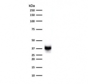Western blot testing of human COLO-38 cell lysate with PMEL17 antibody (clone MSSG95).