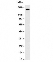 Western blot testing of HCT116 cell lysate and CD56 antibody. Observed molecular weights: 120, 140 and 180 kDa.