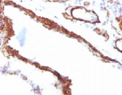 IHC testing of FFPE rat lung with Smooth Muscle Actin antibody (clone SMAT2-1). Staining of formalin-fixed tissues requires boiling tissue sections in pH 9 10mM Tris with 1mM EDTA for 10-20 min followed by cooling at RT for 20 min.