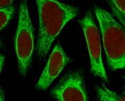 Immunofluorescent staining of permeabilized human HeLa cells with Smooth Muscle Actin antibody (green, clone SMAT2-1) and Reddot nuclear stain (red).