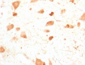 IHC testing of FFPE rat cerebellum with PGP9.5 antibody (clone UBCE-L1). Staining of formalin-fixed tissues requires boiling tissue sections in pH 9 10mM Tris with 1mM EDTA for 10-20 min followed by cooling at RT for 20 min.~