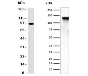 Western blot testing of human spleen lysate (left) and human K562 cell lysate (right) with CD43 antibody (clone CDLA43). Predicted molecular weight 45-135 kDa depending on glycosylation level.~