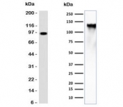 Western blot testing of human spleen lysate (left) and human K562 cell lysate (right) with CD43 antibody (clone CDLA43). Predicted molecular weight 45-135 kDa depending on glycosylation level.