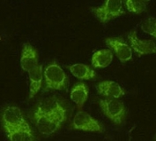 Immunofluorescent staining of permeabilized human HeLa cells with Fascin antibody (clone FAN55-1, green).