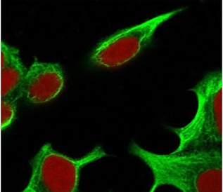 Immunofluorescent staining of PFA-fixed human HepG2 cells with TNF-alpha antibody (green, clone TMDa1-1) and Reddot nuclear stain (red).~