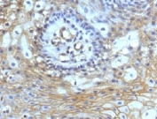 IHC testing of FFPE human tongue with CD59 antibody (clone CDLA59-1).