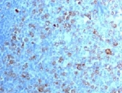 IHC testing of FFPE human tonsil with CDK1 antibody (clone CDVC2-1). Staining of formalin-fixed tissues requires boiling tissue sections in pH 9 10mM Tris with 1mM EDTA for 10-20 min followed by cooling at RT for 20 min.