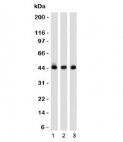 Western blot of 1) K562, 2) 293 and 3) A549 cell lysates using Napsin A antibody (clone NPSNA-1). Expected molecular weight: 38-45 kDa depending on glycosylation level.