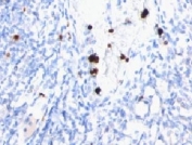 IHC testing of FFPE human tonsil with MYDAM antibody (clone MYUP1). FFPE testing requires sections to be boiled in pH 9 10mM Tris with 1mM EDTA for 10-20 minutes, followed by cooling at RT for 20 minutes, prior to staining.