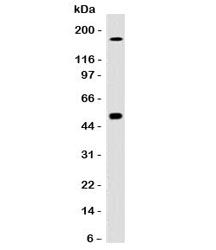 Western blot testing of HCT116 cell lysate with CAIX antibody (clone CBAD9-1). Predicted molecular weight: 50-55 kDa.~