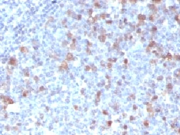 IHC testing of FFPE human tonsil with Cdc20 antibody (clone CLDC20-1). FFPE testing requires sections to be boiled in pH 9 10mM Tris with 1mM EDTA for 10-20 minutes, followed by cooling at RT for 20 minutes, prior to staining.~
