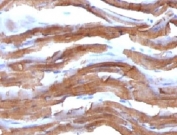 IHC testing of FFPE rat heart with Muscle Actin antibody (clone PMAC1-1). FFPE testing requires sections to be boiled in pH 9 10mM Tris with 1mM EDTA for 10-20 minutes, followed by cooling at RT for 20 minutes, prior to staining.