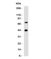 Western blot testing of human skeletal muslce with Muscle Actin antibody (clone PMAC1-1). Predicted molecular weight ~42 kDa.
