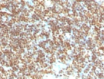 IHC testing of FFPE human tonsil with dsDNA antibody (clone DRNC1-1). FFPE testing requires sections to be boiled in pH 9 10mM Tris with 1mM EDTA for 10-20 minutes, followed by cooling at RT for 20 minutes, prior to staining.~