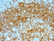 IHC testing of FFPE human tonsil with CD74 antibody (clone CDLA74-1). HIER: FFPE testing requires sections to be boiled in pH6 10mM citrate buffer for 10-20 minutes, followed by cooling at RT for 20 minutes, prior to staining.