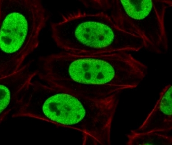 Immunofluorescent staining of paraformaldehyde fixed human HeLa cells with Ku70 + Ku80 antibody (clone LKAP1-1, green) and Phalloidin cell membrane stain (red).~
