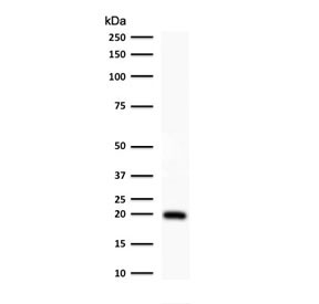 Western blot testing of human HeLa cell lysate with Ferritin antibody (clone FTLC1-1). Predicted molecular weight: ~20 kDa.~