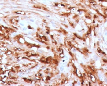 IHC staining of FFPE human pancreas with recombinant Ferritin antibody (clone FTLC1-1). HIER: boil tissue sectio