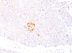 IHC testing of FFPE human pancreas with NSE antibody (clone NSEL1-1). Staining of FFPE tissue requires boiling sections in pH 9 10mM Tris with 1mM EDTA for 10-20 min followed by cooling at RT for 20 min.~