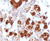 IHC testing of FFPE human pituitary gland with ACTH antibody (clone ADCT1-1).