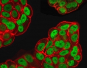Immunofluorescent staining of PFA-fixed human MCF7 cells with FOXA1 antibody (clone FHBA1-1, green) and Phalloiden (red).