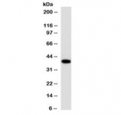 Western blot testing of human lung lysate with EpCAM antibody (clone EPM17-4). Expected molecular weight: ~35 kDa (unmodified), 40-43 kDa (glycosylated).