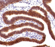 IHC testing of FFPE human fallopian tube with EpCAM antibody (clone EPM17-4). Staining of FFPE tissue requires boiling sections in pH 9 10mM Tris with 1mM EDTA for 10-20 min followed by cooling at RT for 20 min.