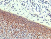 IHC testing of FFPE human skin with E-Cadherin antibody (clone ECD1-2). HIER: steam sections in pH6 citrate buffer for 20 min.