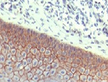 IHC testing of FFPE human skin with E-Cadherin antibody (clone ECD1-2). HIER: steam sections in pH6 citrate bu