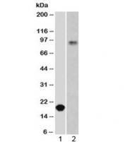 Western blot testing of 1) partial recombinant protein and 2) human stomach lysate using E-Cadherin antibody at 0.5ug/ml. Expected molecular weight: 135 kDa (precursor), 80-120 kDa (mature, depending on gylcosylation level).