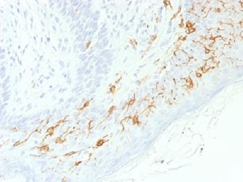 IHC testing of FFPE human skin with recombinant CD1a antibody (clone C1A/1506R). Required HIER: boil tissue sections in 10mM Citrate buffer, pH 6, for 10-20 min.~