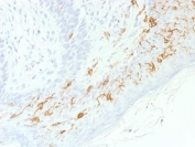 IHC testing of FFPE human skin with recombinant CD1a antibody (clone C1A/1506R). Required HIER: boil tissue sections in 10mM Citrate buffer, pH 6, for 10-20 min.