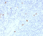 IHC testing of human tonsil with IgG4 antibody (clone IHCG4-1). Staining of FFPE tissue is enhanced by boiling sections in 10mM Tris with 1mM EDTA, pH9 for 10-20 min followed by cooling at RT for 20 min.