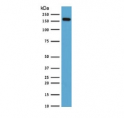 Western blot testing of human HeLa cell lysate with Topoisomerase II alpha antibody (clone TPM2A-2). Expected molecular weight ~174 kDa.