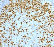 IHC testing of FFPE human tonsil with Topoisomerase II alpha antibody (clone TPM2A-2).