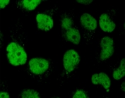 Immunofluorescent staining of PFA-fixed human HeLa cells with Topoisomerase II alpha antibody (clone TPM2A-2).