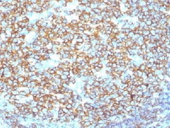 IHC testing of recombinant CD20 antibody and FFPE human tonsil tissue. Required HIER: steam section in pH 9 10mM Tris with 1mM EDTA for 20 min.~