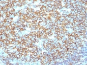 IHC testing of recombinant CD20 antibody and FFPE human tonsil tissue. Required HIER: steam section in pH 9 10mM Tris with 1mM EDTA for 20 min.