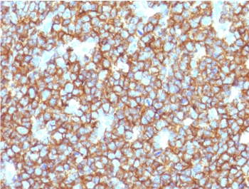 IHC testing of recombinant CD20 antibody and FFPE human tonsil tissue. HIER: steam section in pH 9 10mM Tris with 1mM EDTA for 20 min.~