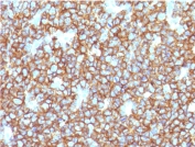 IHC testing of recombinant CD20 antibody and FFPE human tonsil tissue. HIER: steam section in pH 9 10mM Tris with 1mM EDTA for 20 min.