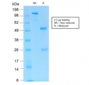 SDS-PAGE analysis of purified, BSA-free recombinant CD31 antibody (clone C31/1395R) as confirmation of integrity and purity.