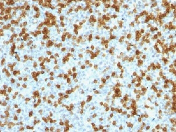 IHC testing of FFPE human tonsil with recombinant PD1 antibody (clone PDCD1/1410R). Required HIER: steam sections in 10mM Tris with 1mM EDTA, pH 9, for 10-20 min.~