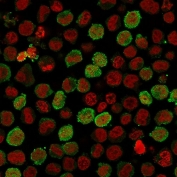 Immunofluorescent staining of PFA-fixed human K562 cells with recombinant Calponin antibody (green, clone CNN1/1408R) and Reddot nuclear stain (red).